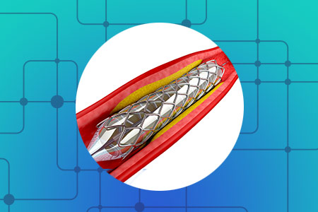 Angioplastia (Art�ria Car�tida)